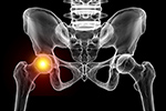 Hip Discomfort? Explore Non-Surgical Options With Dr. Domb