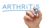 Treating Arthritis Without Surgery
